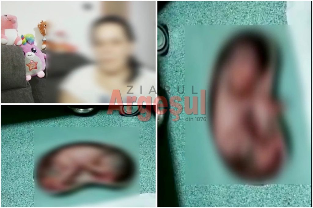 Imagini de groază cu bebelușul viu aruncat la gunoi de doctor