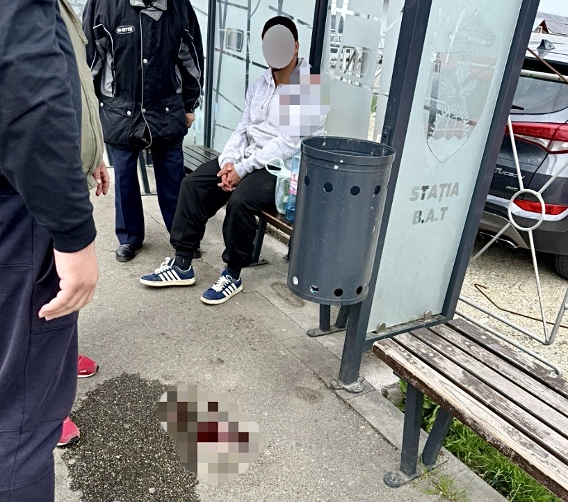 Poza pentru articolul Argeș: Pericol mortal într-o stație de autobuz! Tânăr grav rănit, la un pas de tragedie